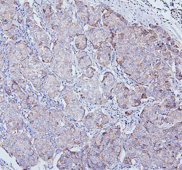 Anti-TRPV3 Antibody Picoband® Boster Bio