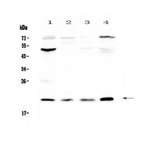 Anti-Kallikrein 2/KLK2 Antibody Picoband® Boster Bio
