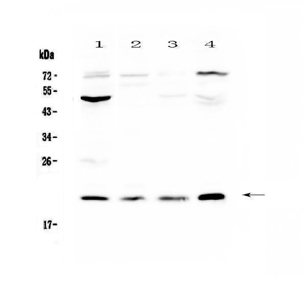 Anti-Kallikrein 2/KLK2 Antibody Picoband® Boster Bio