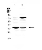 Anti-CD23/FCER2 Antibody Picoband® Boster Bio