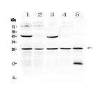 Anti-Noggin Antibody Picoband® Boster Bio