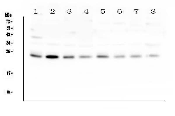 Anti-RAB11B Antibody Picoband® Boster Bio