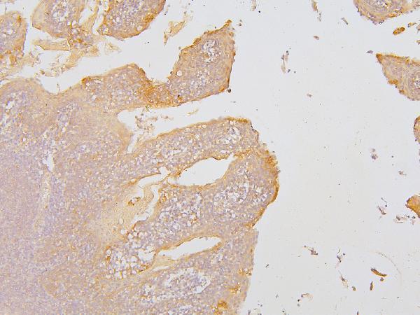 Anti-KCC2/SLC12A5 Antibody Picoband® Boster Bio