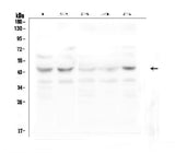 Anti-GPR2/CCR10 Antibody Picoband® Boster Bio