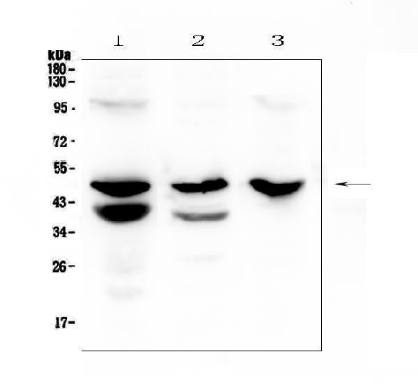 Anti-Cathepsin E/CTSE Antibody Picoband® Boster Bio