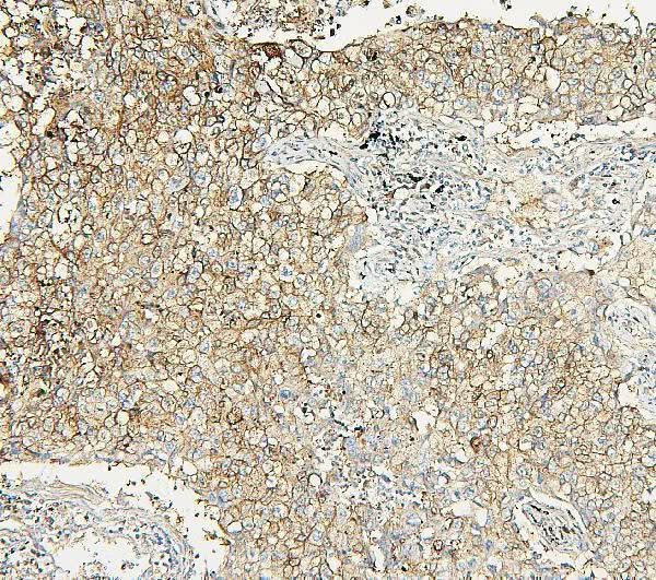 Anti-Aldolase/ALDOA Antibody Picoband® Boster Bio