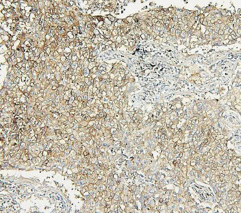 Anti-Aldolase/ALDOA Antibody Picoband® Boster Bio