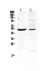 Anti-MMP16 Antibody Picoband® Boster Bio