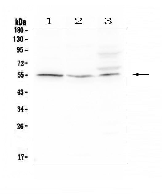 Anti-D6/ACKR2 Antibody Picoband® Boster Bio