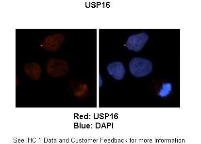 Anti-USP16 Antibody Picoband® Boster Bio