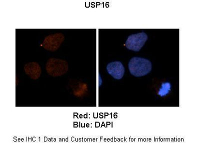 Anti-USP16 Antibody Picoband® Boster Bio