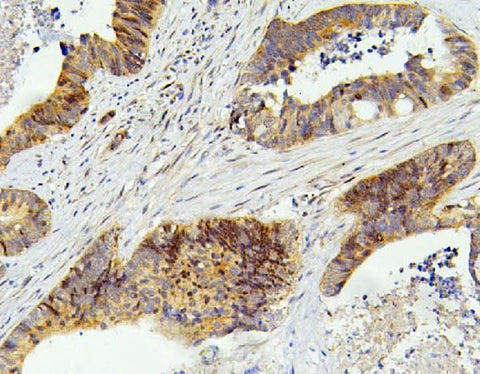 Anti-SMARCAD1 Antibody Picoband® Boster Bio