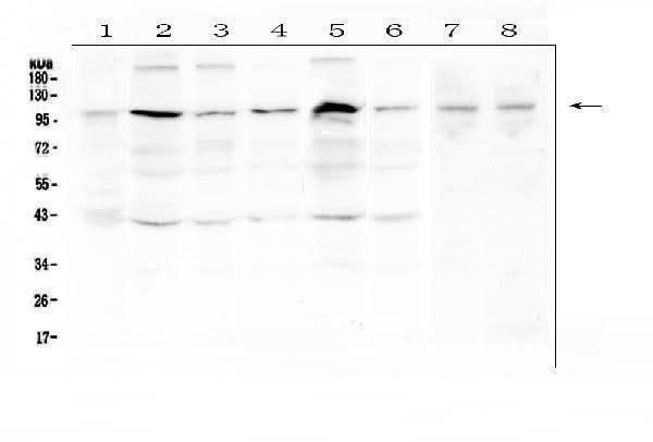 Anti-RSK3/RPS6KA2 Antibody Picoband® Boster Bio