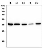 Anti-CD160 Antibody Picoband® Boster Bio