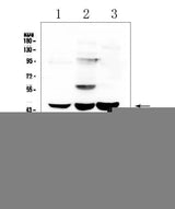 Anti-ELAVL2 HuB Antibody Picoband® Boster Bio