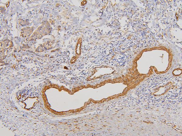 Anti-RAB3GAP2 Antibody Picoband® Boster Bio