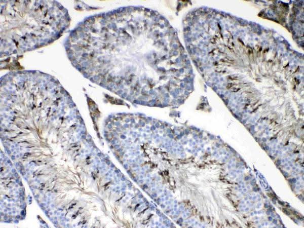 Anti-FMN1 Antibody Picoband® Boster Bio