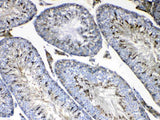Anti-FMN1 Antibody Picoband® Boster Bio