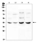Anti-GPCR GPR7/NPBWR1 Antibody Picoband® Boster Bio