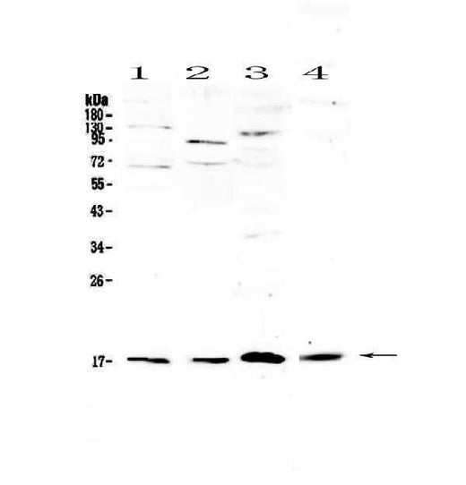 Anti-IL1F10 Antibody Picoband® Boster Bio