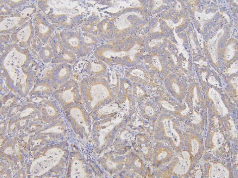 Anti-RNF123 Antibody Picoband® Boster Bio