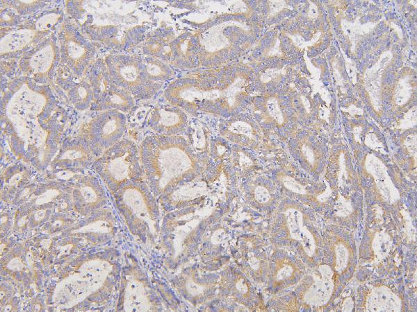 Anti-RNF123 Antibody Picoband® Boster Bio