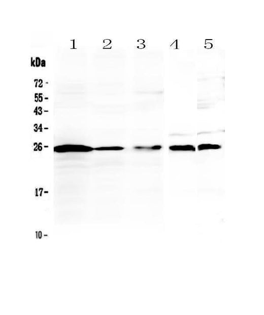 Anti-IL36 alpha/IL36A Antibody Picoband® Boster Bio