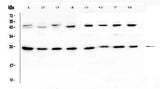 Anti-IL36 alpha/IL36A Antibody Picoband® Boster Bio