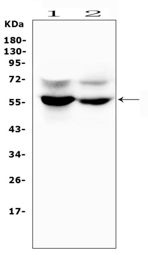 Anti-GLUT6/SLC2A6 Antibody Picoband® Boster Bio