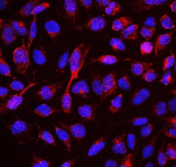 Anti-RBMS3 Antibody Picoband® Boster Bio
