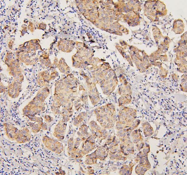 Anti-PYROXD1 Antibody Picoband® Boster Bio