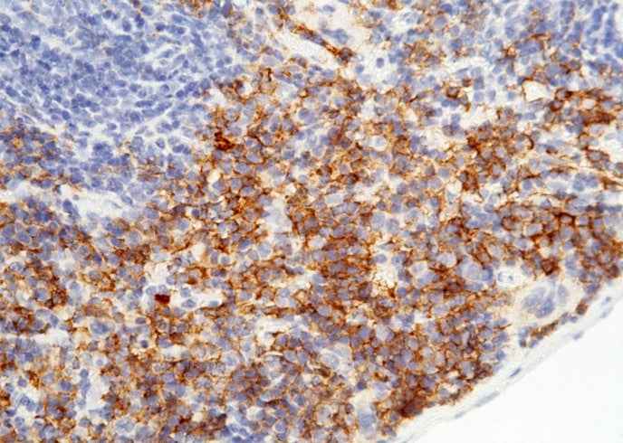 Anti-Mouse FCGR1 Antibody [B401]