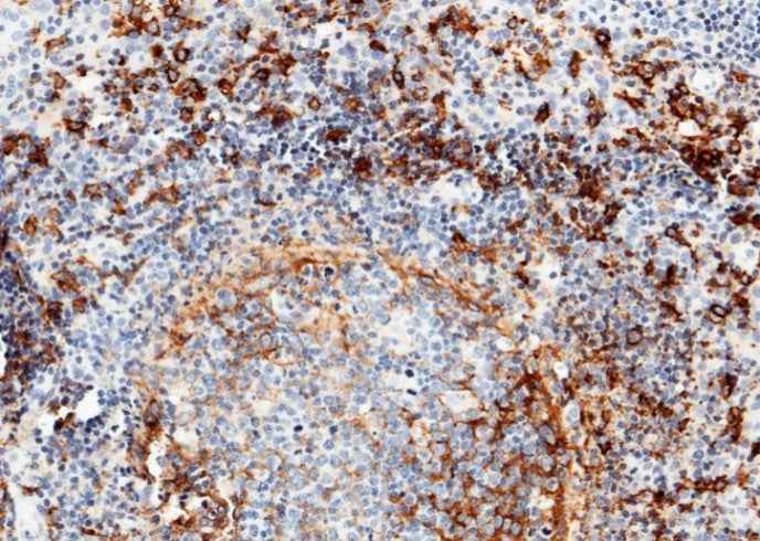 Anti-Human CD14 Antibody [A1289] - ABMIUM