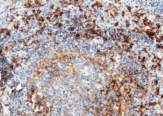 Anti-Human CD14 Antibody [A1289] - ABMIUM