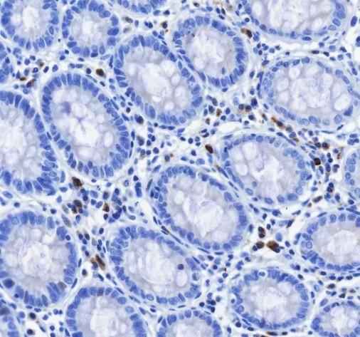 Anti-Human IGJ Antibody [A508]