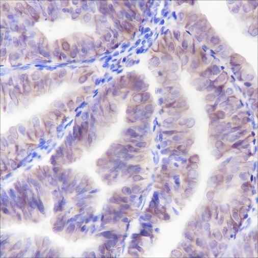 Anti-Human/African green monkey ALOX15 Antibody [A127] - ABMIUM
