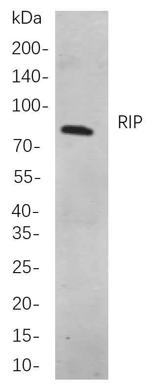 Anti-Human RIP Antibody [B841] - ABMIUM