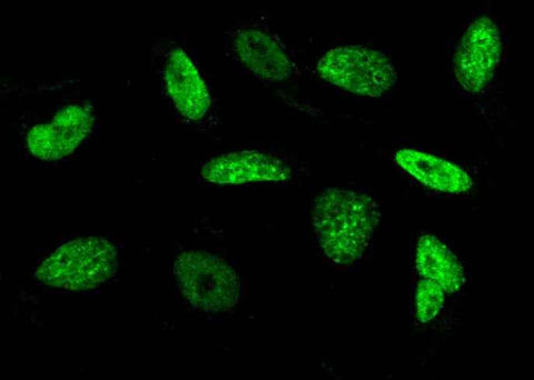 Anti-Human Histone H3 Antibody [A1003] - ABMIUM
