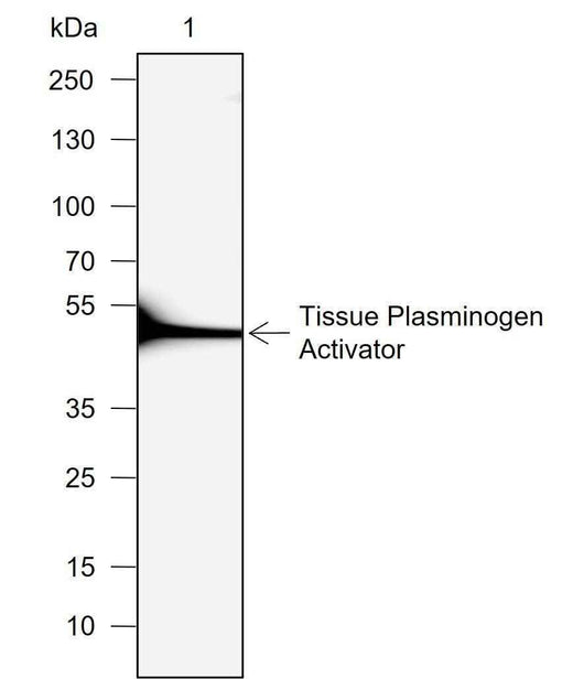 Anti-Human/Rat Tissue Plasminogen Activator Antibody [A725] - ABMIUM