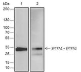 Anti-Human/Rat/Mouse SFTPA1+SFTPA2 Antibody [A534]