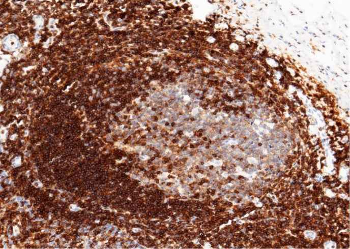 Anti-Human ICAM3 Antibody [A1152] - ABMIUM