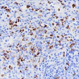 Anti-Human/Rat/Mouse CD15/SSEA1 Antibody [A159]