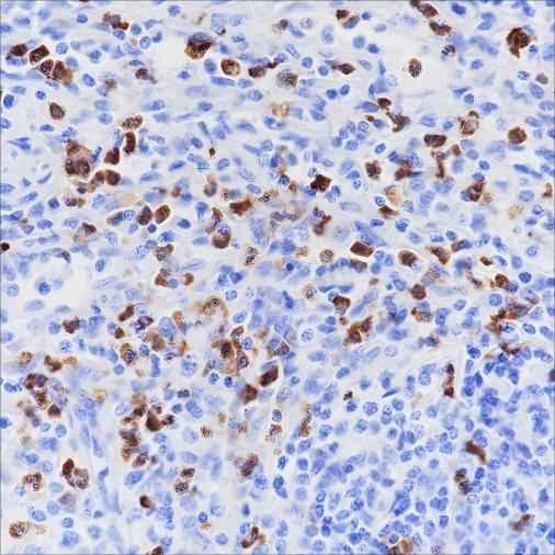 Anti-Human/Rat/Mouse CD15/SSEA1 Antibody [A159] - ABMIUM