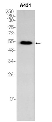 p53 western blot of human A431 cell extracts, antibody 1:1000