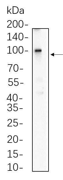 Anti-Human/Mouse/Rat β Catenin Antibody [B675] - ABMIUM