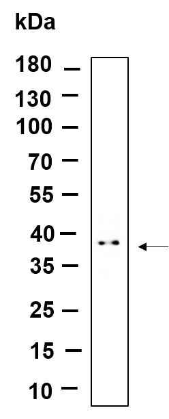 Anti-Human/Mouse/Rat STML2 Antibody [B914] - ABMIUM