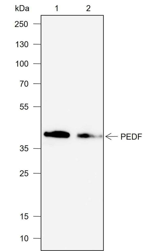 Anti-Human PEDF Antibody [A704] - ABMIUM