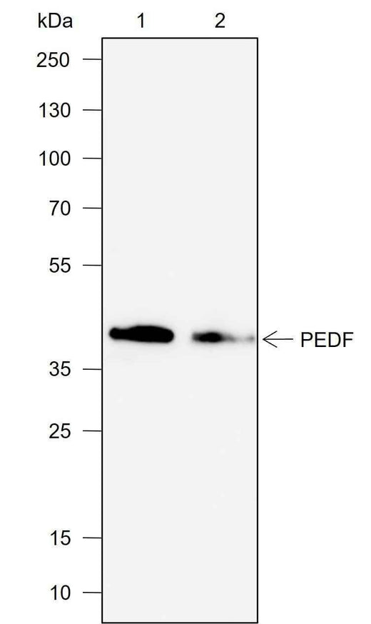 Anti-Human PEDF Antibody [A704] - ABMIUM