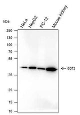 Anti-Human/Rat/Mouse GOT2 Antibody [A237]