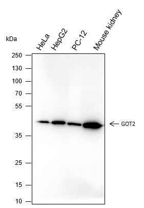 Anti-Human/Rat/Mouse GOT2 Antibody [A237] - ABMIUM